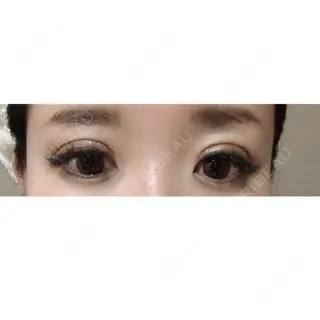 13日目の経過画像（2枚目）