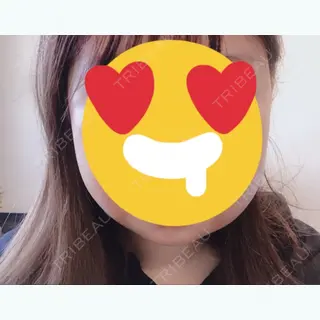 2日目の経過画像（1枚目）