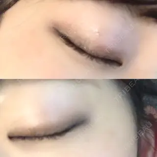 18日目の経過画像（2枚目）