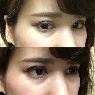 21日目の経過画像（2枚目）