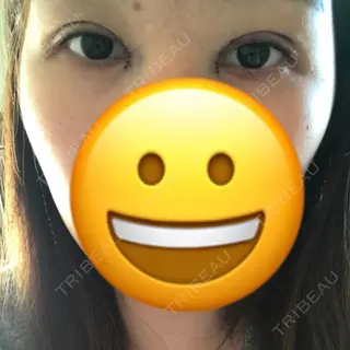0日目の経過画像（1枚目）