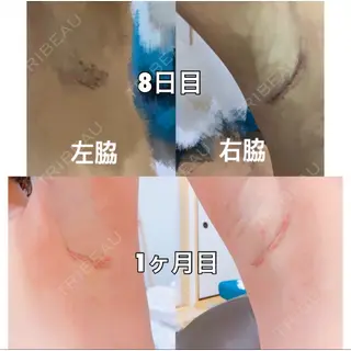 28日目の経過画像（3枚目）