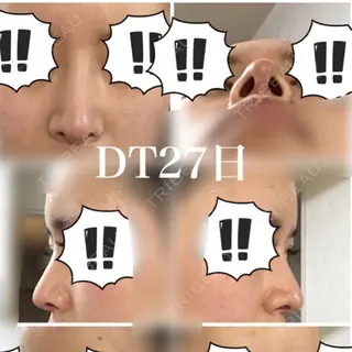 27日目の経過画像（1枚目）