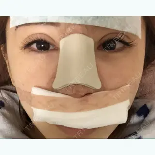 1日目の経過画像（1枚目）