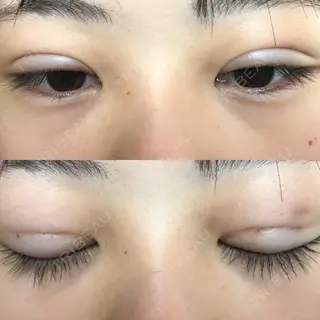 7日目の経過画像（2枚目）
