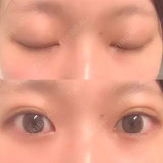 20日目の経過画像（2枚目）