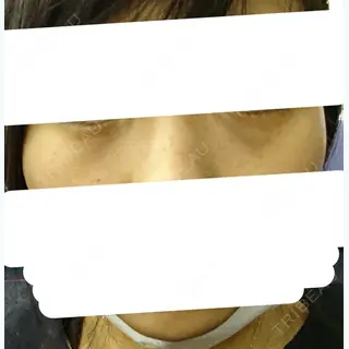 8日目の経過画像（1枚目）