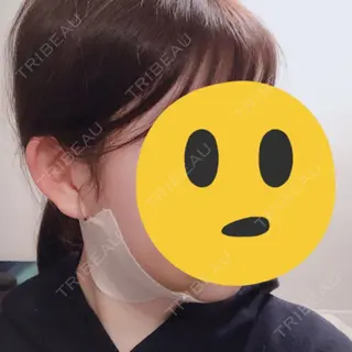 4日目の経過画像（3枚目）