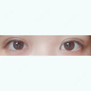 9日目の経過画像（1枚目）