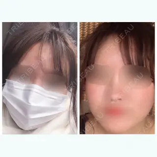 25日目の経過画像（1枚目）