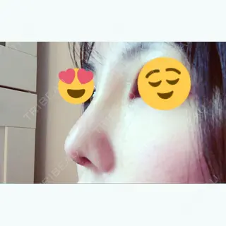 8日目の経過画像（2枚目）