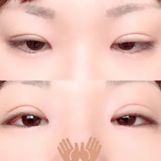 19日目の経過画像（2枚目）