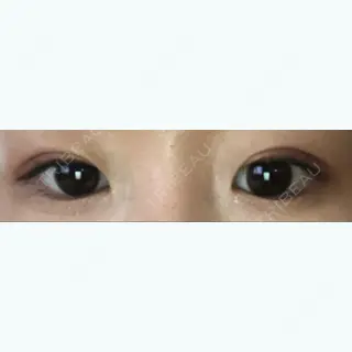 28日目の経過画像（2枚目）