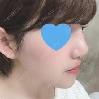 11日目の経過画像（2枚目）