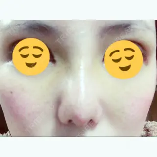 9日目の経過画像（3枚目）