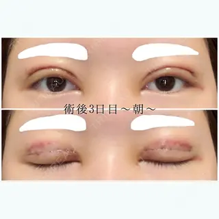 3日目の経過画像（1枚目）