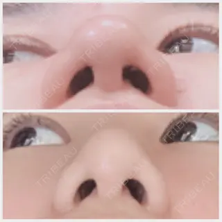 8日目の経過画像（2枚目）