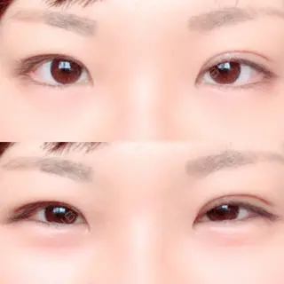 20日目の経過画像（1枚目）