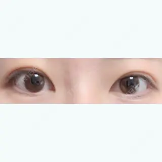 6日目の経過画像（1枚目）