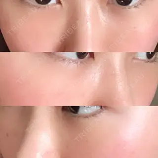 8日目の経過画像（1枚目）