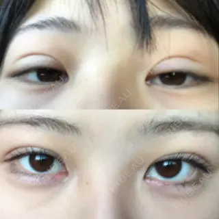 8日目の経過画像（3枚目）