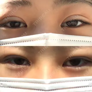 10日目の経過画像（3枚目）