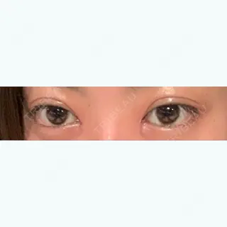1日目の経過画像（1枚目）