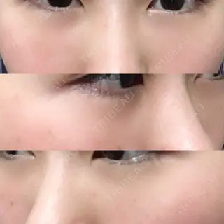 9日目の経過画像（1枚目）
