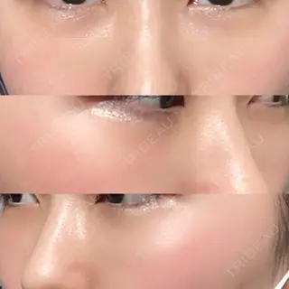 9日目の経過画像（2枚目）