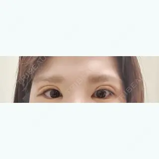 9日目の経過画像（1枚目）