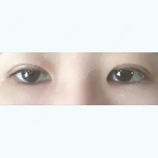 18日目の経過画像（1枚目）