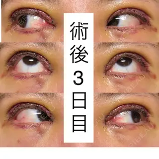3日目の経過画像（3枚目）
