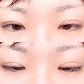 23日目の経過画像（2枚目）