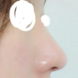 18日目の経過画像（1枚目）
