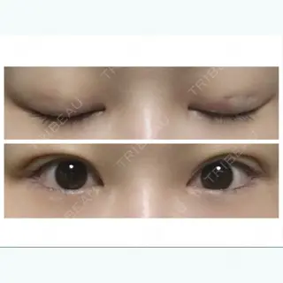4日目の経過画像（1枚目）