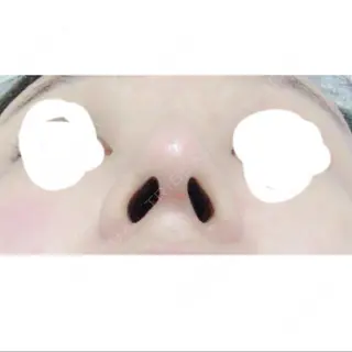 18日目の経過画像（3枚目）