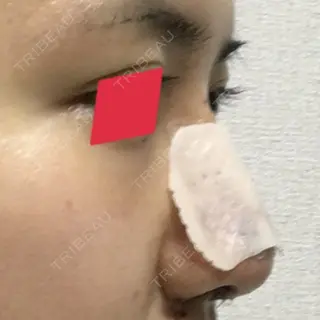 2日目の経過画像（2枚目）
