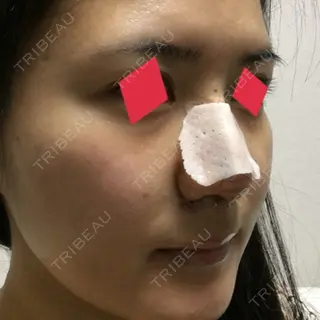 3日目の経過画像（2枚目）