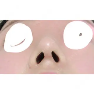 19日目の経過画像（3枚目）