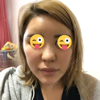 10日目の経過画像（1枚目）