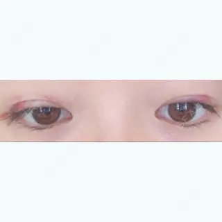 8日目の経過画像（2枚目）