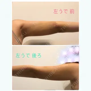 5日目の経過画像（2枚目）