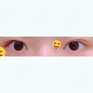 8日目の経過画像（2枚目）
