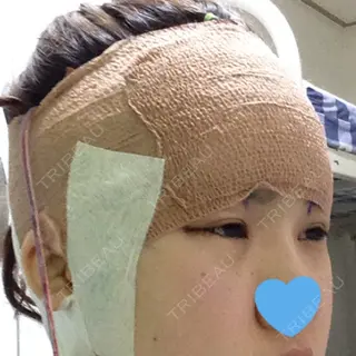 1日目の経過画像（2枚目）