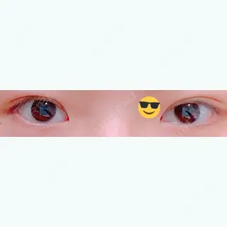 9日目の経過画像（2枚目）
