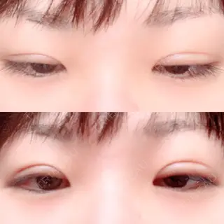 26日目の経過画像（2枚目）