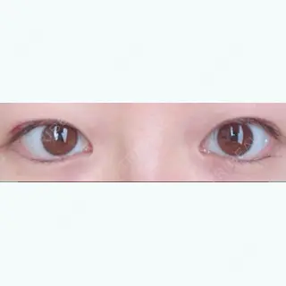 10日目の経過画像（1枚目）