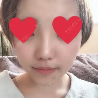 18日目の経過画像（1枚目）