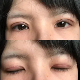 9日目の経過画像（1枚目）