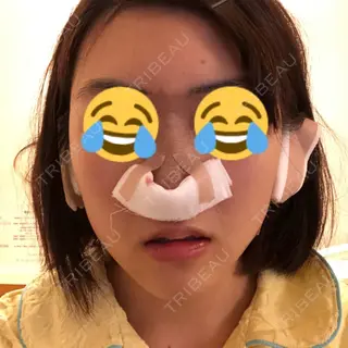 0日目の経過画像（1枚目）